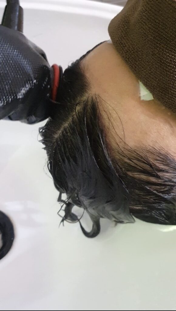천영허브 염색 후 두피에 남은 노폐물과 각질ㄹ을 완벽하게 제거하는 두피 디톡스 워터펀치 시술 과정