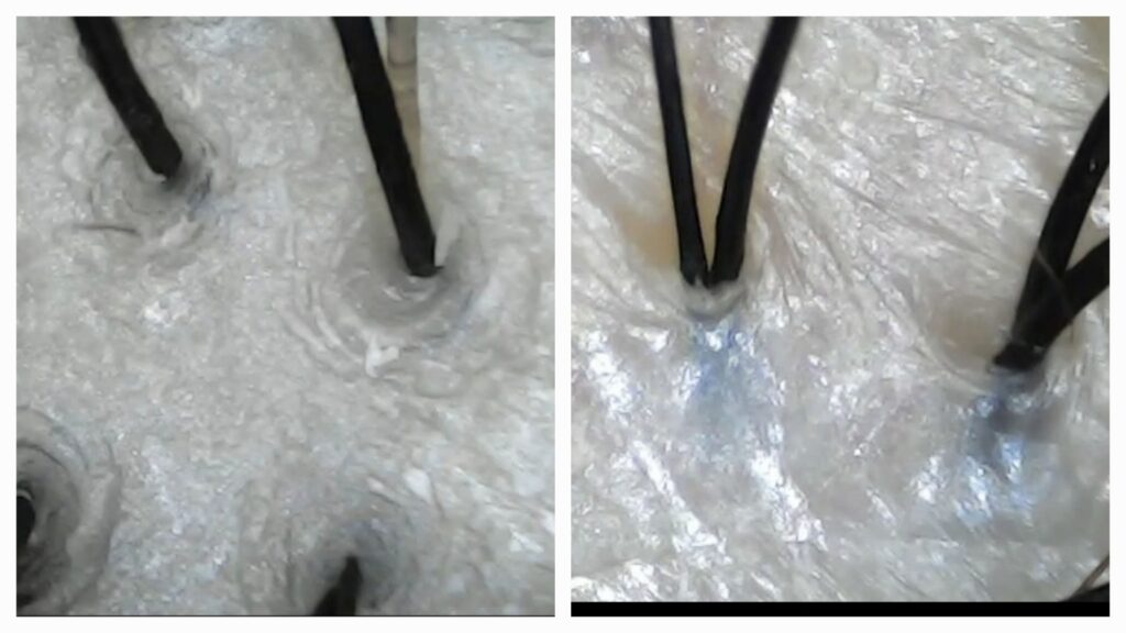모낭과 피지선이 밀집된 두피 피부 구조와 산화 피지 비교